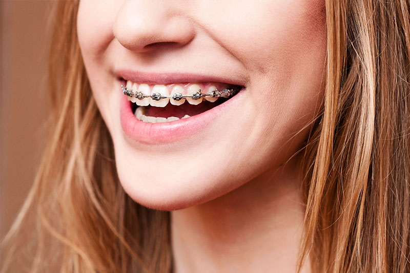 North Hollywood Orthodontics